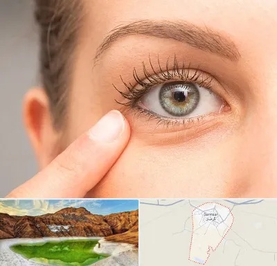 جراح پف چشم در گرمسار