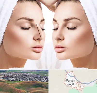 عمل بینی در فارسان