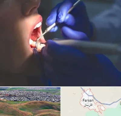 عصب کشی در فارسان