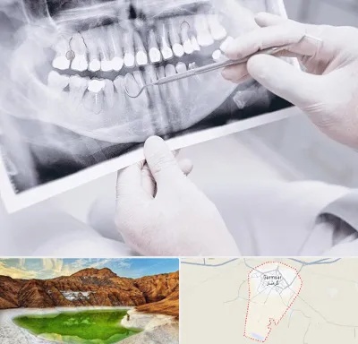 رادیولوژی دهان و دندان در گرمسار