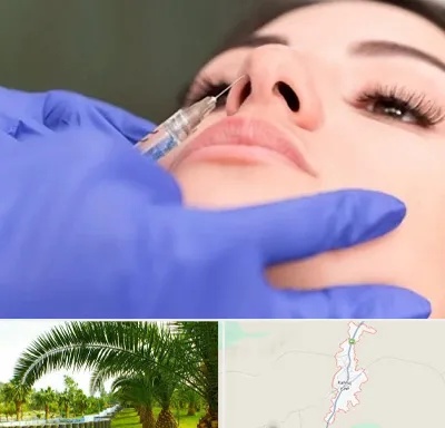 هیالاز در کهنوج