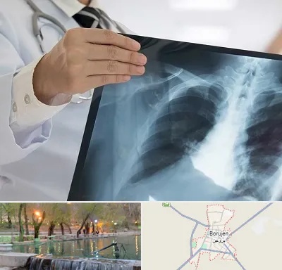 فوق تخصص ریه در بروجن