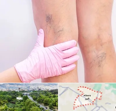 دکتر فوق تخصص واریس در البرز