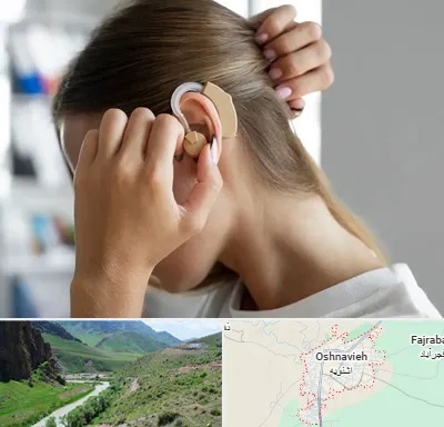 فروش اقساطی سمعک در اشنویه