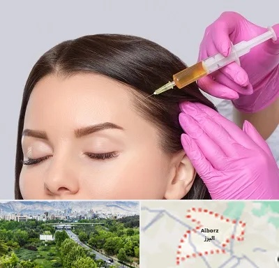 تزریق هیر فیلر در البرز