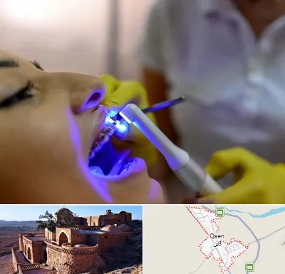 دندانپزشکی با لیزر در قائن