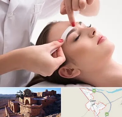 اپیلاسیون در قائن