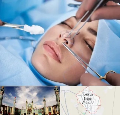 عمل ترمیمی بینی در آران و بیدگل