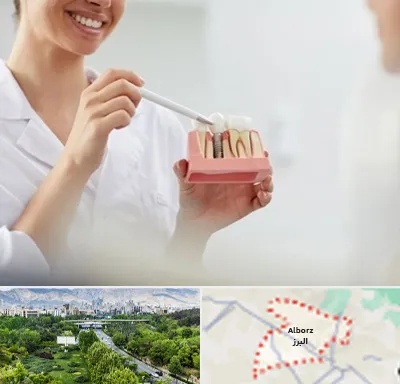 دکتر دندانساز در البرز