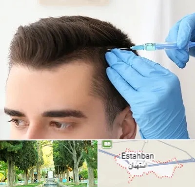 مزوتراپی مو در استهبان