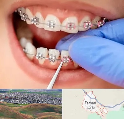 مرکز ارتودنسی دندان در فارسان