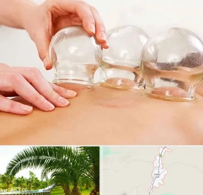 بادکش درمانی در کهنوج