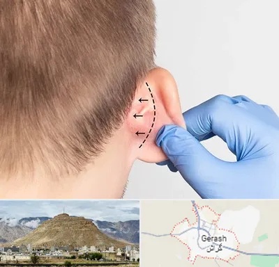 عمل زیبایی گوش در گراش