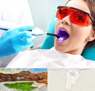 جراحی لثه با لیزر در گرمسار