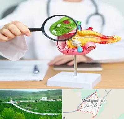 جراح سرطان پانکراس در مشگین شهر