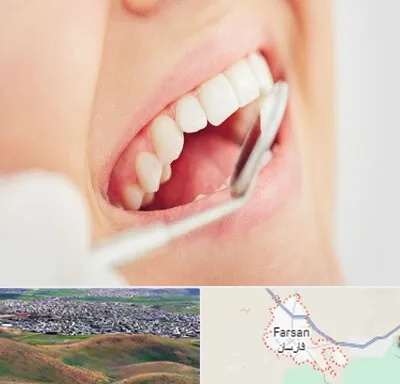 اصلاح طرح لبخند در فارسان