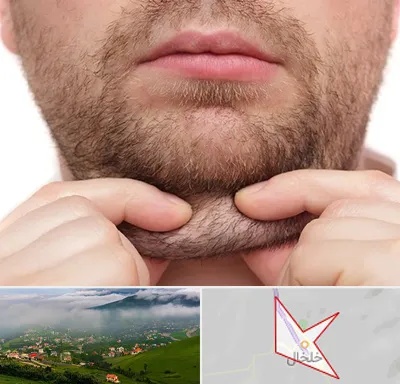 ساکشن غبغب در خلخال
