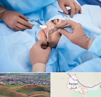 عمل بینی فانتزی در فارسان