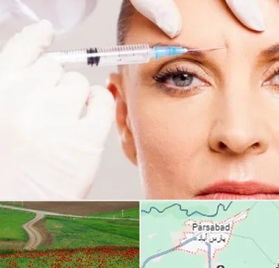 مزوژل در پارس آباد