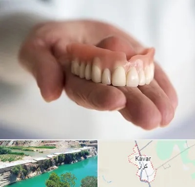 لیفت لثه با لیزر در کوار