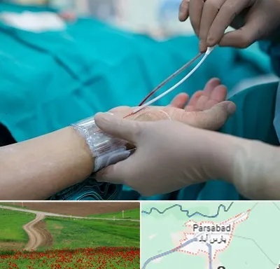 آنژیوگرافی در پارس آباد