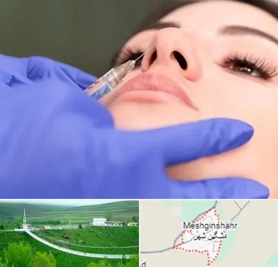 هیالاز در مشگین شهر