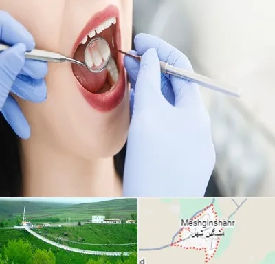 جراح دندان عقل در مشگین شهر