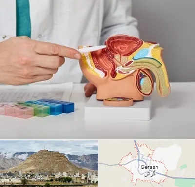 دکتر اورولوژی در گراش
