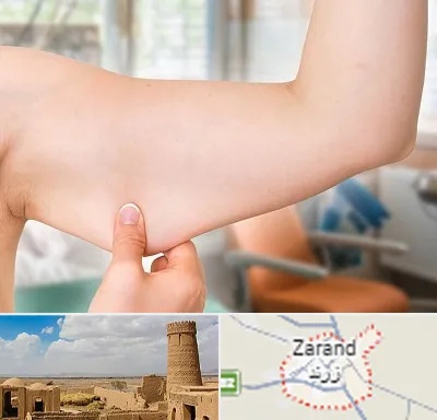 براکیوپلاستی در زرند