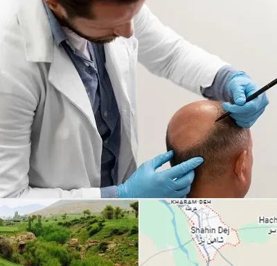 کاشت مو به روش تکثیری در شاهین دژ
