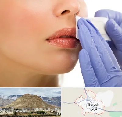اپیلاسیون صورت در گراش