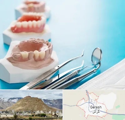 متخصص روکش دندان در گراش