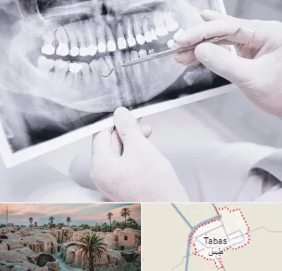 رادیولوژی دهان و دندان در طبس