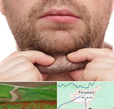ساکشن غبغب در پارس آباد