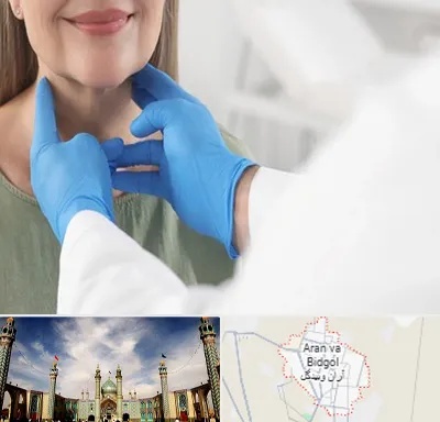 جراح سرطان گلو در آران و بیدگل