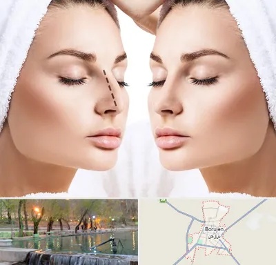 عمل بینی در بروجن
