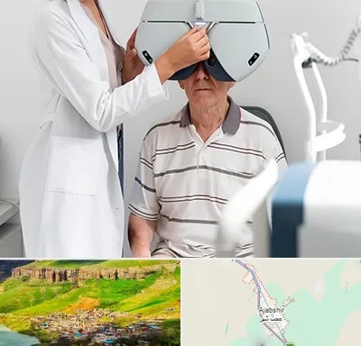 دکتر سرطان چشم در عجب شیر
