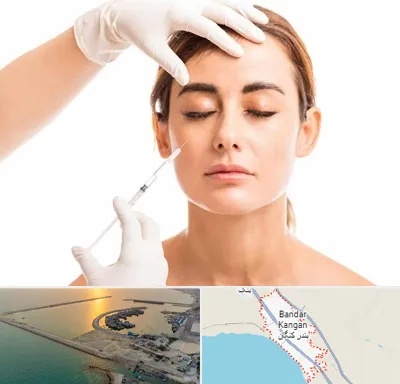 تزریق ژل گونه در بندر کنگان