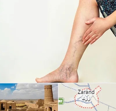 دکتر واریس در زرند