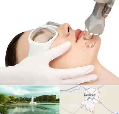 لیزر فرکشنال در لردگان