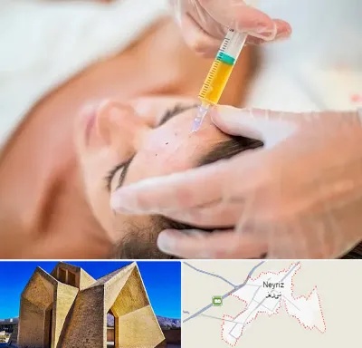 پی آر پی در نی ریز