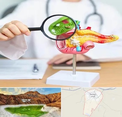 جراح سرطان پانکراس در گرمسار
