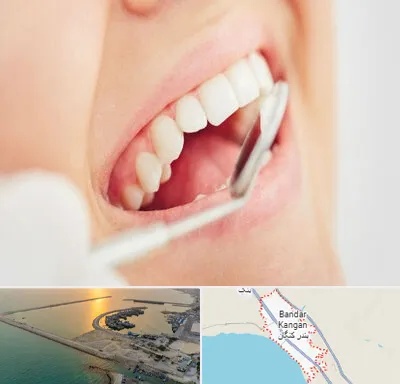 اصلاح طرح لبخند در بندر کنگان