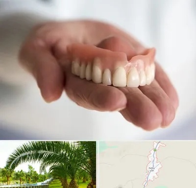 لیفت لثه با لیزر در کهنوج