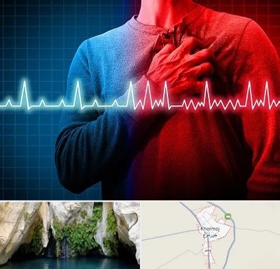 نوار قلب در خورموج
