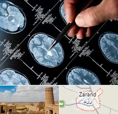 دکتر تشنج در زرند