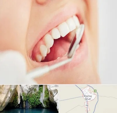 اصلاح طرح لبخند در خورموج
