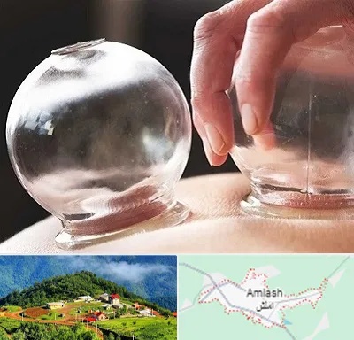 مرکز حجامت در املش