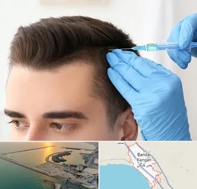 مزوتراپی مو در بندر کنگان