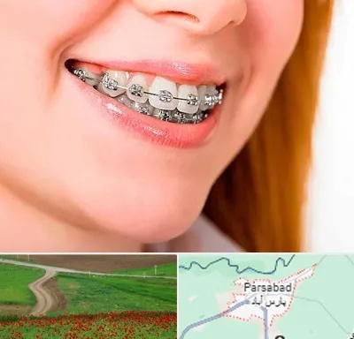 ارتودنسی ارزان در پارس آباد